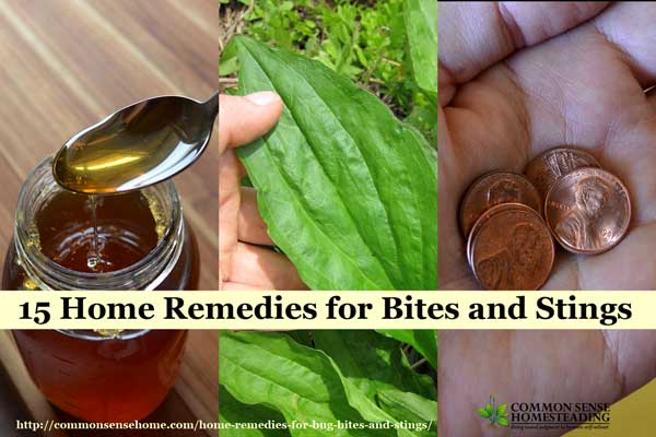 15 Home Remedies for Bug Bites and Stings - use these items from around your home and yard to reduce pain, swelling and itching from bug bites and stings.