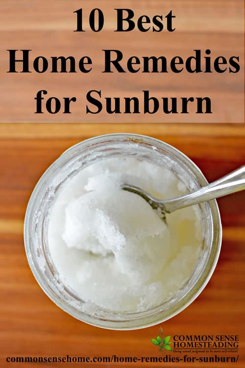 Home Remedies for Sunburn - 10 Best Sunburn Remedies to help bring relief from sunburn pain and speed healing from your face to your toes.