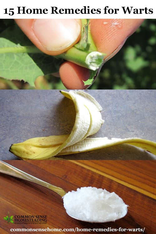 15 Home Remedies for Warts - Cheap and easy to use, these home wart treatments will help you get rid of warts on hand and fingers, plantar warts and more.