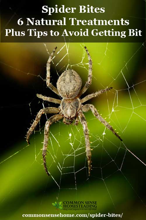 Spider Bites - 6 Natural Treatments Plus Tips to Avoid Getting Bit - Sooth the pain and itching of spider bites, and learn how to avoid them.