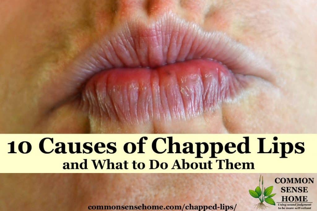 Whether they're caused by too much dry air or medical conditions, chapped lips can be uncomfortable. With a little TLC, you can treat and repair dry lips.