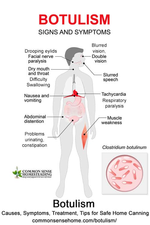 Botulism Causes Symptoms Treatment Tips For Safe Home Canning Botulism Causes Symptoms Treatment Tips For Safe Home Canning