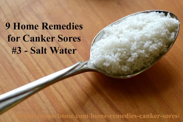 home remedies for canker sores