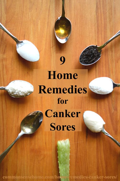 9 Home Remedies For Canker Sores Tips To Avoid Canker Sore Triggers