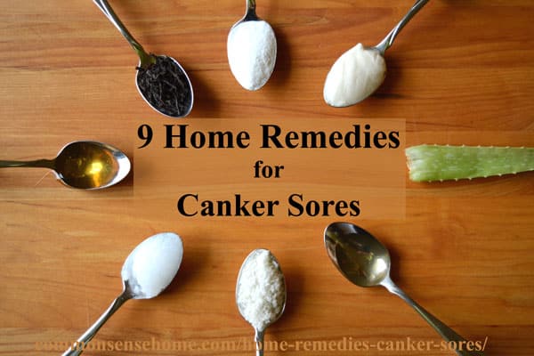 9 Home Remedies For Canker Sores Tips To Avoid Canker Sore Triggers