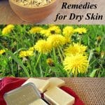 dry skin remedies