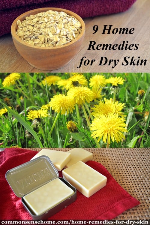 dry skin remedies