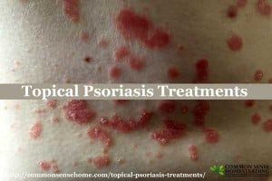 Topical Psoriasis Treatments - Relief for Dry, Flaking Skin