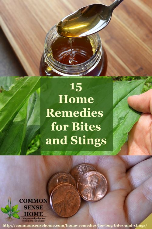 15 Home Remedies for Bug Bites and Stings - For Mosquito Bites & More