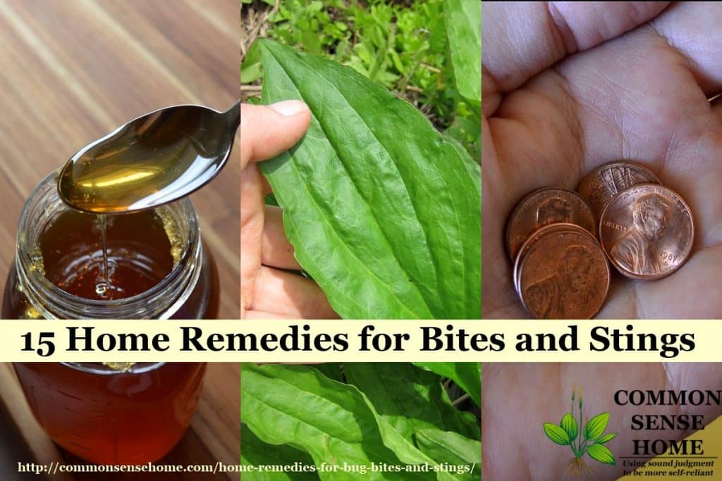 15 Home Remedies For Bug Bites And Stings For Mosquito Bites More