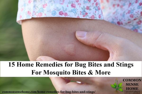 Bug Bites (Including Spider Bites & Bee Stings) Mosquito-bite-treatment