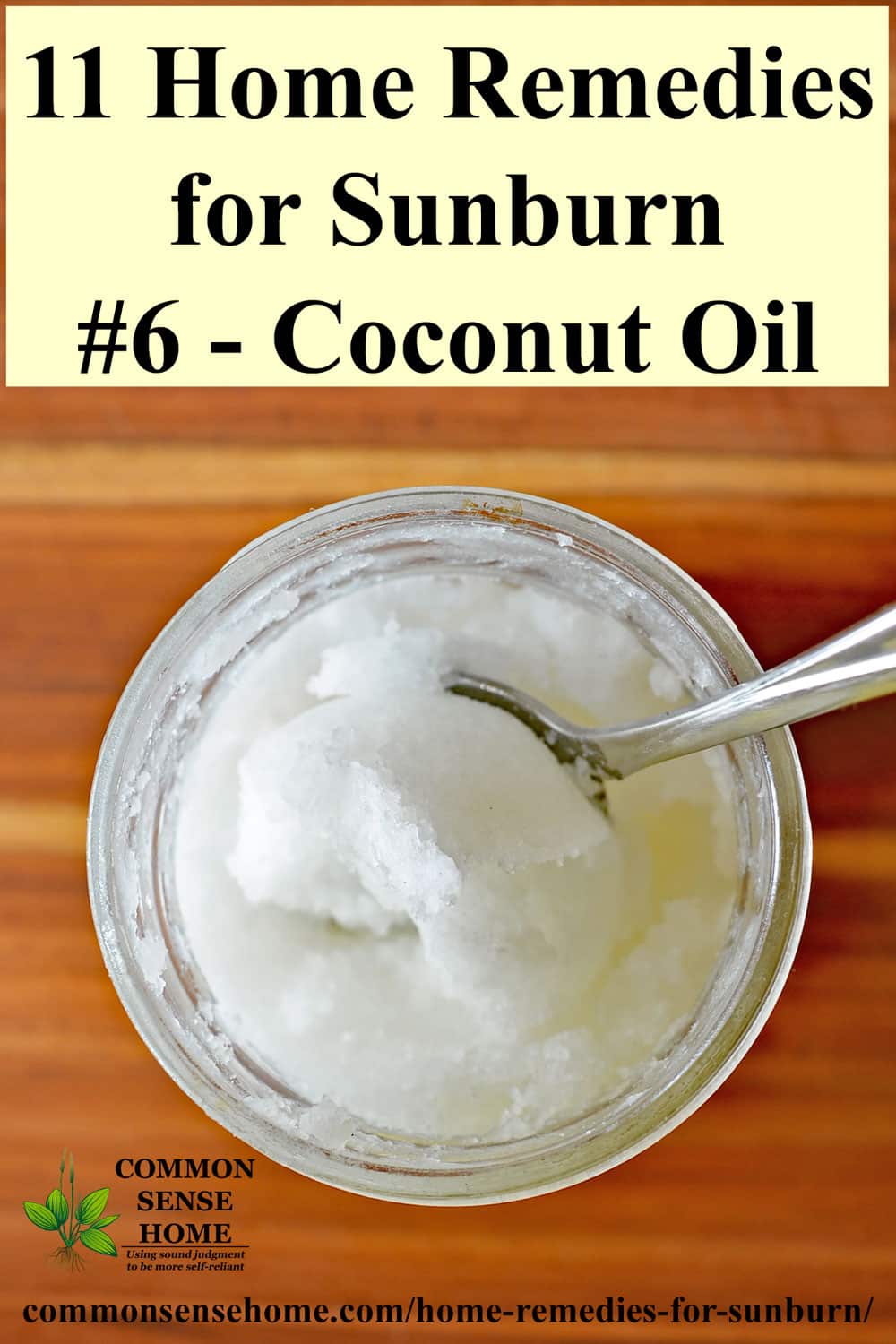 coconut oil for sunburn relief