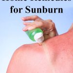aloe for sunburn relief on sunburned shoulder