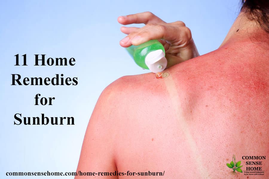 Natural Sunburn Remedies. Lakeshore RV Blog
