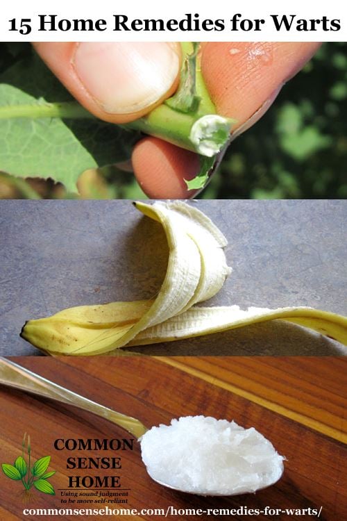 Collage of home remedies for warts