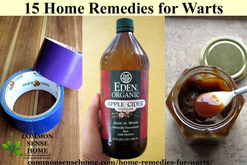 Collage of home remedies for warts