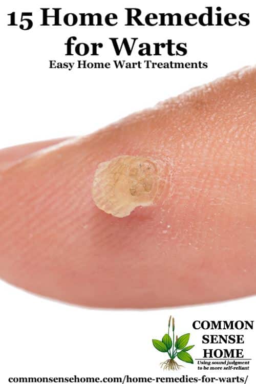 Wart on skin treatment