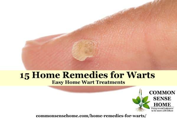 15 Home Remedies For Warts Easy Home Wart Treatments