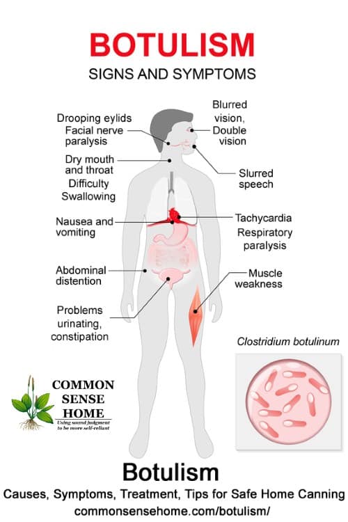 botulism symptoms