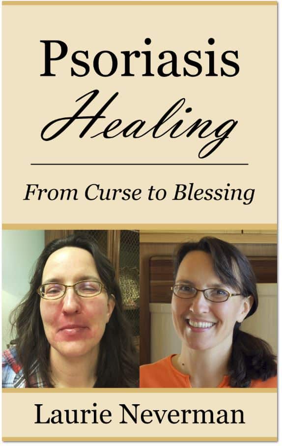 "Psoriasis Healing: From Curse to Blessing" book cover