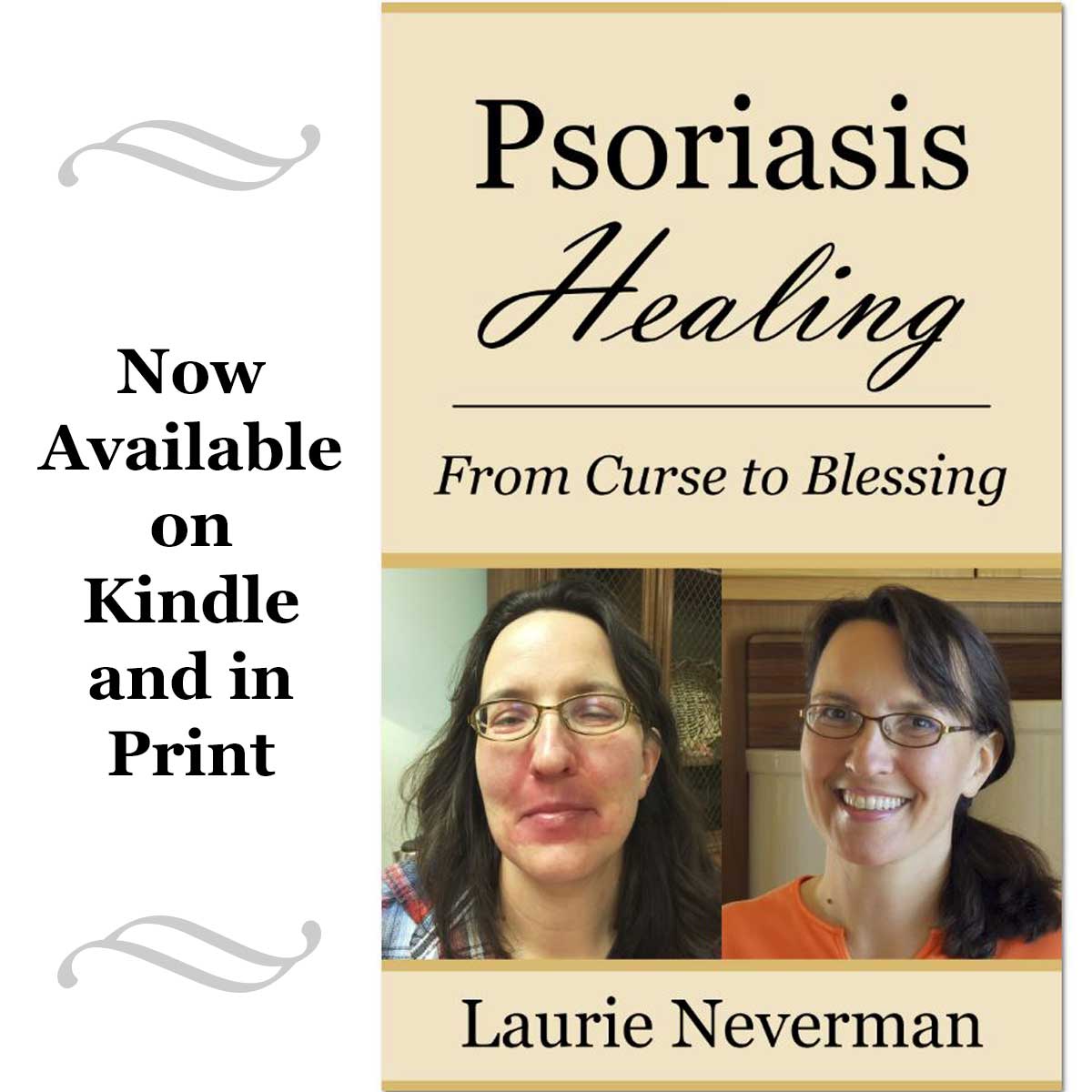 "Psoriasis Healing: From Curse to Blessing" book cover