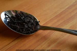 Canker Sore Treatment (How to Get Rid of Canker Sores)