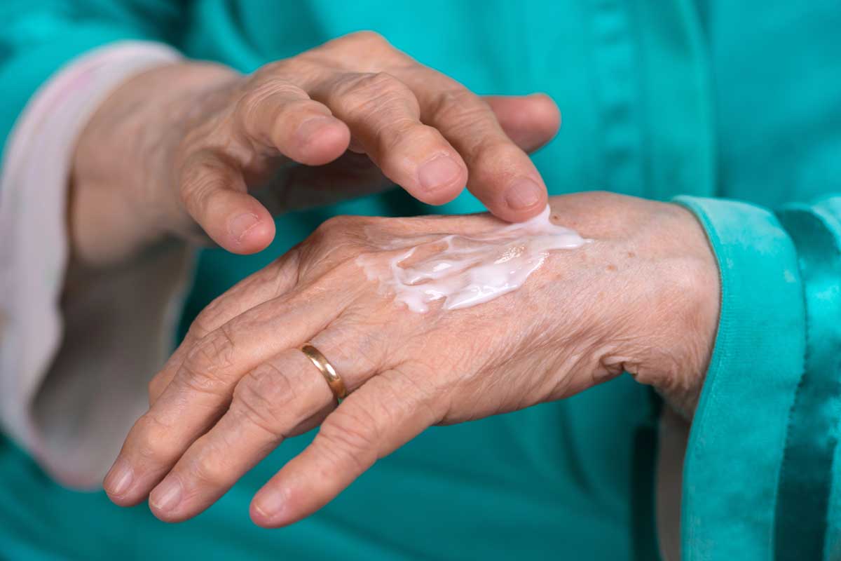 woman applying arthritis cream