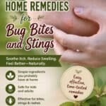 20+ Home Remedies for Bug Bites and Stings - For Mosquito Bites & More